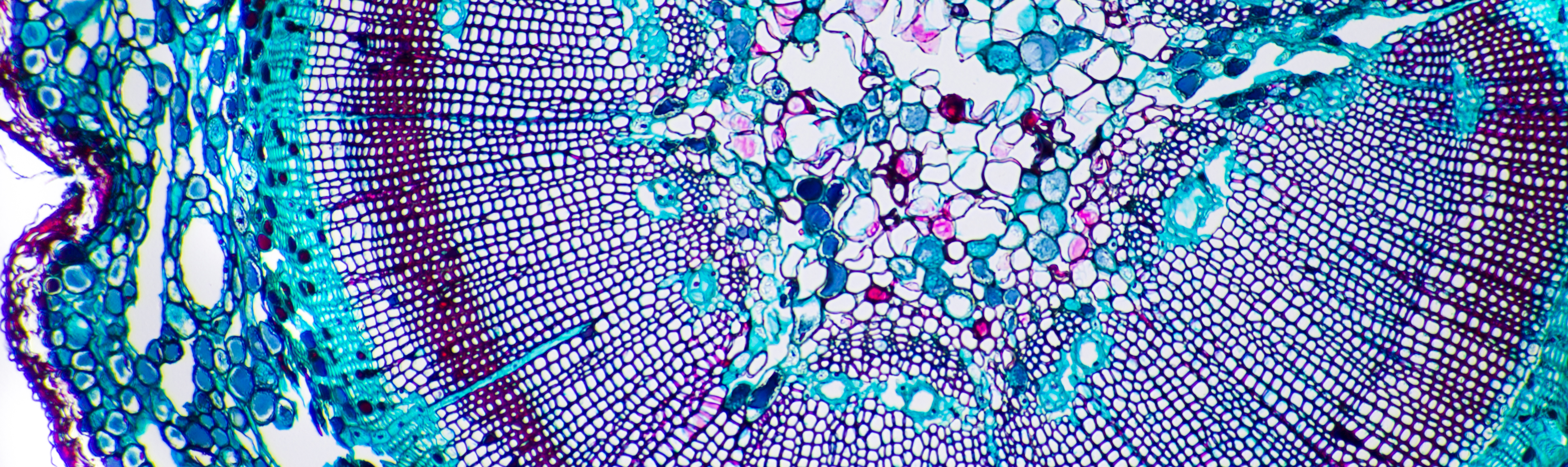 Vegetal tissue micrography of Corn stem dyed blue and purple