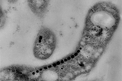 Bacteria with magnetic crystals of magnetite (line of dark blocks), which they have assembled from elemental iron to use as compasses.